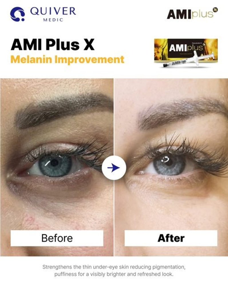 AMI Plus X - Image 5